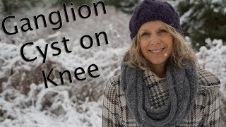 Ganglion Cyst on Knee Can Yoga Help [upl. by Karola]