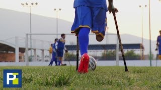 El fútbol no discrimina estos jugadores forman parte de un equipo de amputados en México [upl. by Atteoj]