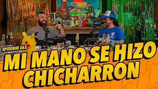 Episodio 263  5 ANIVERSARIO  Mi mano se hizo chicharrón [upl. by Ahsimaj]