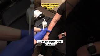 Arm SCRAPING Pain Relief IASTM Graston chiropractic paintreatment painrelief [upl. by Atteram]