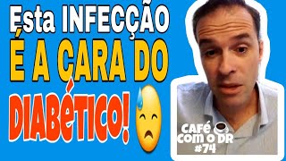 A infecção mais típica dos diabéticos sabe qual é  Café com o Dr ☕ 75 [upl. by Pang]