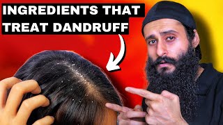 AntiDandruff Ingredients That You Should Know  Bearded Chokra [upl. by Laon]