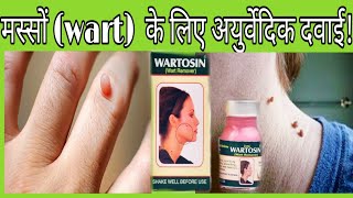 Wart remover lotion  मस्सों के लिए अयुर्वेदिक दवाई  Wartosin wart remover Ayurvedic lotion [upl. by Hunfredo638]