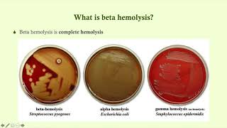 Group A BetaHemolytic Strep S pyogenes  Microbiology Boot Camp [upl. by Viole473]