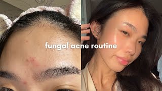 fungal acne safe skincare routine that cleared my skin [upl. by Lemieux314]