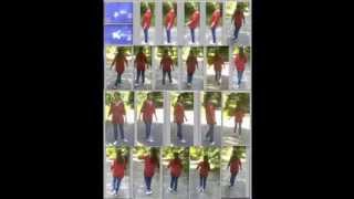 Video 9  Ataxia  Freeze frames  Ataxie  Arrêts sur images [upl. by Kwan679]