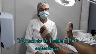 TRATAMENTO DE PEELING PARA RETIRADA DE CALOSIDADE PODOLOGA VALÉRIA NASCIMENTO [upl. by Esten]