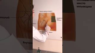 Injection 🔥 tutorial топ littos tutorial injection doctor shorts [upl. by Dowdell]