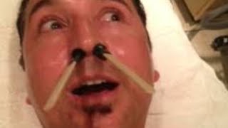 HILARIOUS MEN WAXING COMPILATION  WAXING WHOLE FACE [upl. by Attennod]