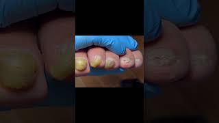 Wonderful pedicure video pedicure satisfying [upl. by Norvan]