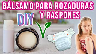 POMADA PARA ROZADURAS Y RASPONES – PARA BEBÉ Y ADULTO – Mixi [upl. by Zebulon307]