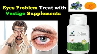 Vestige eye support capsules benefits in hindi  how to use vestige eye support capsules [upl. by Neirbo]