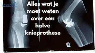 Alles wat je moet weten over een halve knieprothese [upl. by Yrffoeg]