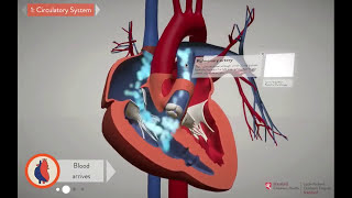 Repairing the Heart Unifocalization  Stanford Childrens Health [upl. by Ettenan]