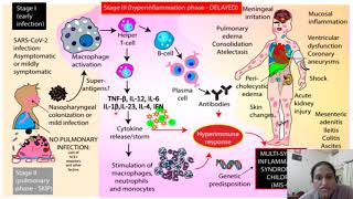 Multisystem Inflammatory Syndrome in Children related to COVID19 [upl. by Adieren292]