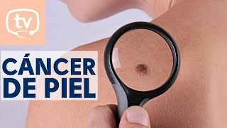 Todo lo que debes saber sobre el cáncer de piel [upl. by Eural]