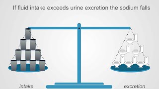 Hyponatremia Basics Understanding Water Intake amp Urine Output [upl. by Ddej]