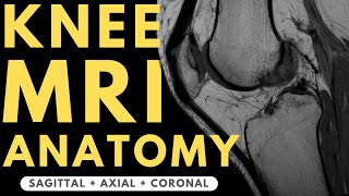 Knee MRI Anatomy  Radiology anatomy part 1 prep  How to interpret a knee MRI [upl. by Harret171]