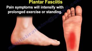 Heel Pain amp The Baxters Nerve  Everything You Need To Know  Dr Nabil Ebraheim [upl. by Yenitirb]