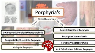 Porphyrias  Types Clinical Features amp Diagnosis [upl. by Arret]