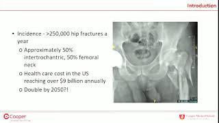 IM nail vs SHS for intertrochanteric femur fractures  debate [upl. by Behka49]