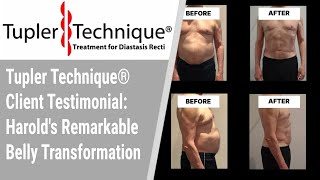 Tupler Technique® Client Testimonial Harolds Remarkable Belly Transformation [upl. by Mychael865]