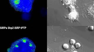 Smart proteins make macrophages better cancereating machines [upl. by Annadroj12]