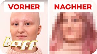 AnnKathrin 18 hat keine Haare Kann man Ihr helfen  SOS  Einsatz der BeautyRetter  taff [upl. by Merfe]