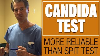 What Does Candida Look Like How to Know if You Have Candida [upl. by Halian]