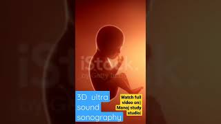 fetal movements 3d animationfetal development 3dmanoj study studioshortstrendingshortsviral [upl. by Anitroc732]