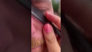 Dandruffflakes removal on eyebrow [upl. by Mayyahk]