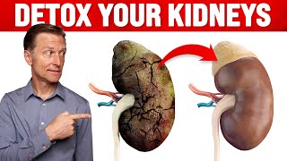 A Surprising Way to Cleanse Toxic Kidneys  Dr Berg on Kidney Detoxification [upl. by Roselia224]