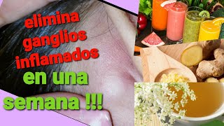 11 Remedios EFECTIVOS💕 para los Ganglios inflamados  te curaras en una semana 💕 [upl. by Alexandros]