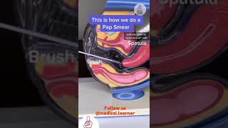 How to do pap smear  pap smear procedure  gynecology pap smear  medical learner  steps to do pap [upl. by Art735]