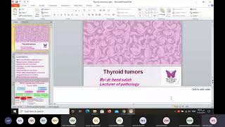 thyroid tumors [upl. by Eniarol392]