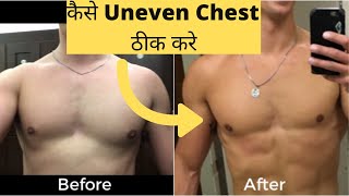 How to Fix Chest Imbalance Easy Tip To Fix Your UNEVEN CHEST GET RESULTS FAST [upl. by Akimal260]