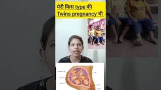 meri kis type ki twins pregnancy thi dichorionic diamniotic twins pregnancy ka kya matlab hota hai [upl. by Anafetse582]