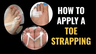 How Do I Do Toe Strapping Dislocated and Fractured Toe [upl. by Nahoj]