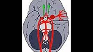 STROCK  CEREBROVASCULAR ACCIDENT  HEALTH EDUCATION  INFECTION CONTROL ICSP  URDU  HINDI [upl. by Patience]