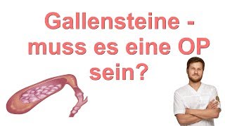 Gallensteine  muss es eine OP sein [upl. by Nohsauq199]