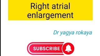 right atrial enlargement। cardiomegaly part 1 [upl. by Eppillihp658]