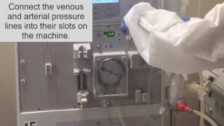 How to setup a dialysis Machine part II Hemodialysis Training [upl. by Xylia]