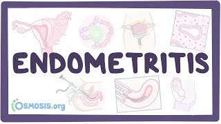 Endometritis  an Osmosis Preview [upl. by Polak]