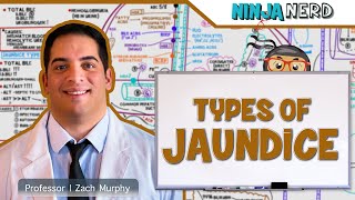 Gastrointestinal  Types of Jaundice [upl. by Cecilio]