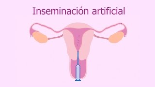 Inseminación artificial [upl. by Otipaga]