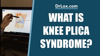 What is Knee Plica Syndrome  Do You Need Plica Surgery  Dr Lox Explains [upl. by Trofmoc]