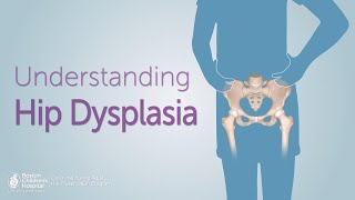 Developmental Dysplasia of the Hip [upl. by Yauq]