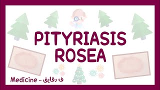 Pityriasis rosea  definition clinical picture diagnosis amp treatment شرح عربي [upl. by Godric]