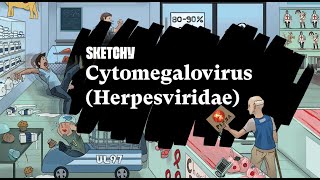 Understanding CytomegalovirusHerpes Virus Family Study Full Lesson Sketchy Medical USMLE Step 1 [upl. by Egni951]