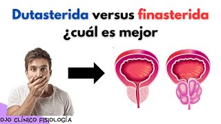 🔴 TAMSULOSINA DUTASTERIDA VS FINASTERIDA PARA LA HIPERPLASIA PROSTÁTICA BENIGNA ¿CUÁL ES MEJOR [upl. by Nwahsan]